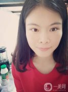 我覺得現(xiàn)在的眼睛還不如手術之前的單眼皮好看呢，正等我為自己更加難看的眼