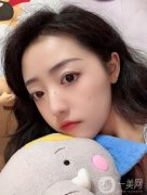 醫(yī)生也是建議本人做個(gè)拉皮的項(xiàng)目，看了許多案例，感覺(jué)做出來(lái)效果相當(dāng)不錯(cuò)