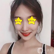 今天終于要完成我多年的夢想，去醫(yī)院做改臉型手術(shù)，心情好激動呀