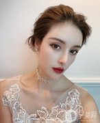 才發(fā)現(xiàn)我的毛囊已經(jīng)完全壞死，也只能通過植發(fā)來進行解決了