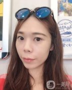做完熱瑪吉項(xiàng)目已經(jīng)兩個(gè)月的時(shí)間了，近我還給醫(yī)生發(fā)去了我現(xiàn)在的照片