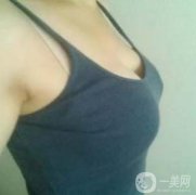 在隆胸拆線之后幾乎我就恢復(fù)了正常的生活了，也可以正常的洗澡了，就是需要