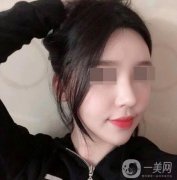 在這里我簡單的和小姐妹們說一下，做完隆鼻手術(shù)之后需要注意什么前一段時間