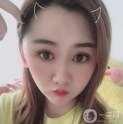 做完拉皮手術(shù)已經(jīng)有兩個月的時(shí)間了，大家看一下，我是不是有了大的變化