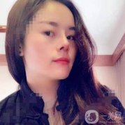 電波拉皮去頸紋第三天，并沒有感覺到不舒服，我現(xiàn)在只要一有時(shí)間就照鏡子