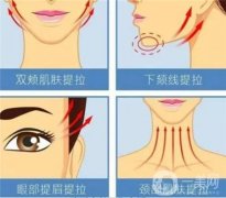 點(diǎn)陣激光有哪些風(fēng)險(xiǎn)和副作用