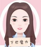 墊下巴有什么優(yōu)缺點?