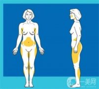 抽脂對身體有影響嗎，抽越多越好嗎