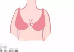 隆胸后悔影響懷孕嗎?