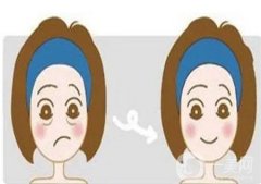 射頻緊膚有什么優(yōu)勢(shì)，不適合的人群有哪些