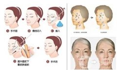 射頻去眼袋有什么優(yōu)勢(shì)，不適合哪些人
