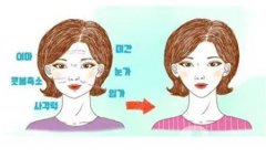 什么是光子嫩膚?光子嫩膚有什么原理