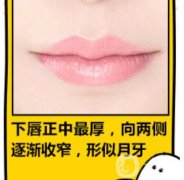 如何區(qū)分骨性突嘴還是牙性突嘴