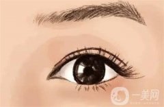 眼窩填充的優(yōu)缺點(diǎn)是什么?恢復(fù)正常需要多久