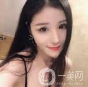 玻尿酸注射后的第一天，很好看，我是那種追求小V的女生