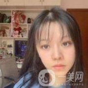 今天的雙眼皮還是有點(diǎn)腫，錄了下來