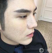 鼻子不好看經(jīng)過長時間的心里斗爭，終我下定決心改變自己