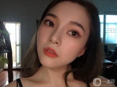 滿月打卡!30天恢復(fù)，鼻子還是很好的，鼻型和鼻腔的切口都很好，沒有異常不適