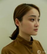 手術(shù)后恢復(fù)了半個月，鼻子不太腫,恢復(fù)的比較自然