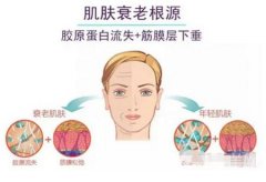 第五代比第四代熱瑪吉有哪些優(yōu)勢(shì)?影響熱瑪吉效果的因素是什么?