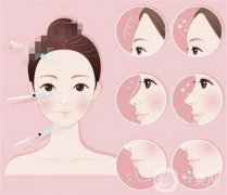 豐全臉的兩種手術(shù)方法詳解!豐全臉適用人群有哪些?