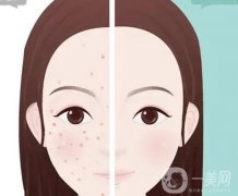 做醫(yī)美皮膚真的會(huì)越來(lái)越好嗎?效果怎么樣?
