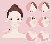 自體脂肪豐全臉的副作用有哪些?注意事項(xiàng)盤(pán)點(diǎn)