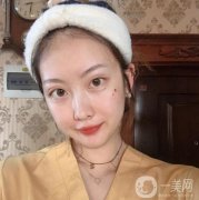 做完熱瑪吉之后，皮膚變得的緊致，滿臉的膠原蛋白