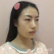 熱瑪吉這個項目真的是特別的神奇，皮膚是越來越穩(wěn)固