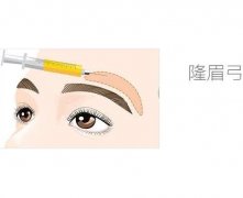 隆眉弓的手術(shù)方法和適宜人群