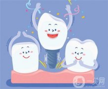 目前種牙多少錢一顆