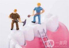 烤瓷牙冠多少錢一顆