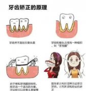 牙齒矯正多大年齡好
