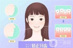 牙齒矯正可以付款嗎_