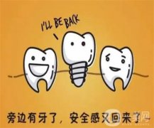 種牙分幾個步驟