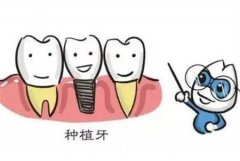 種牙全部過程