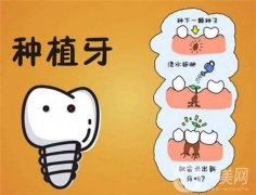 種牙視頻全過程高清
