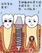 種牙一顆牙大概多少錢