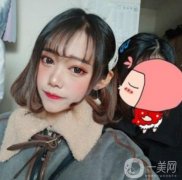 醫(yī)生給我設(shè)計(jì)的這個(gè)下巴實(shí)在是太了