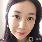 做完熱瑪吉之后，整體的輪廓也是越來越緊致了