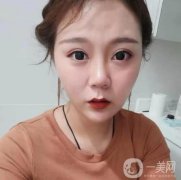 做完熱瑪吉有幾天了，沒有任何不舒服的感覺