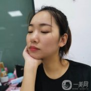 做完拉皮手術(shù)之后，還有些瘦臉型的效果