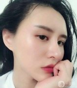 面部填充后，臉摸起來(lái)很軟可以隨意按捏
