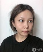 臉部線雕效果好，時(shí)間長(zhǎng)，相對(duì)容易接受微創(chuàng)