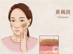 白瓷娃娃的美容原理，做白瓷娃娃痛不痛