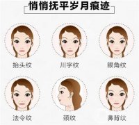 激光祛斑的效果怎么樣呢，好不好