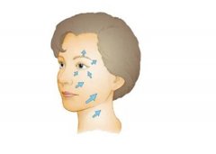 50歲做了拉皮手術(shù)能保持多久