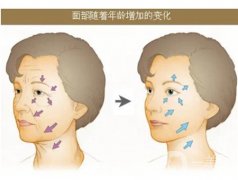 60歲還能做拉皮手術(shù)嗎