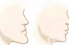 長沙美萊醫(yī)療美容醫(yī)院正頜怎么樣？醫(yī)生資料、技術(shù)優(yōu)勢介紹