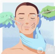 眼睛有皺紋做什么手術(shù)比較好（眼睛皺紋手術(shù)哪種好）